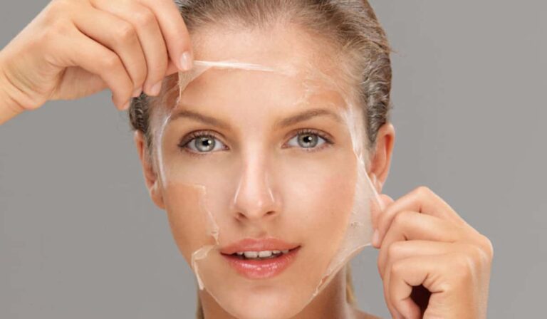 Read more about the article Chemical Peeling