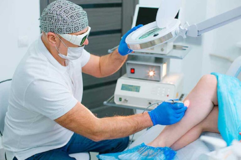 Read more about the article How Painful Is Varicose Vein Laser Treatment?