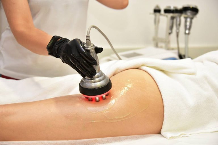 Read more about the article Can Cellulite Come Back After Treatment?